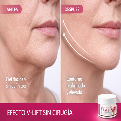 Crema Facial V-Lift – Reafirma, Moldea y Eleva el Contorno Facial
